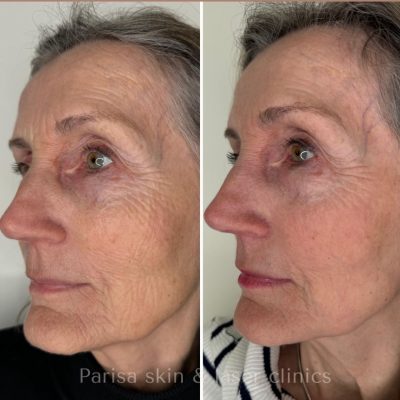 WhatsApp Image 2024-04-23 at 13.41.53